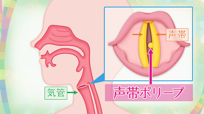 声帯