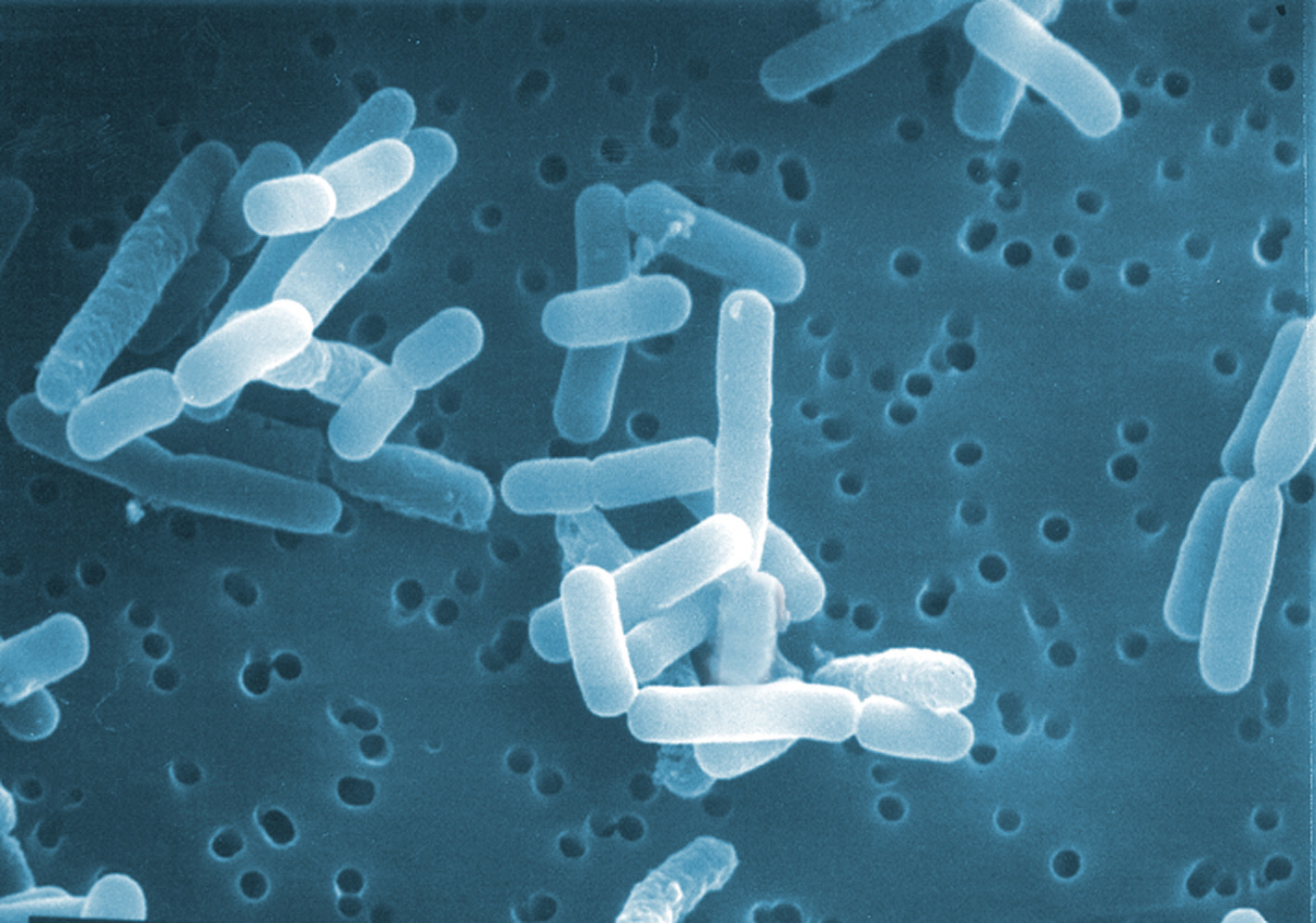 Limosilactobacillus reuteri